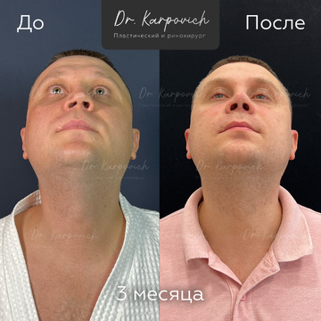 До и после. . Доктор Сергей Карпович